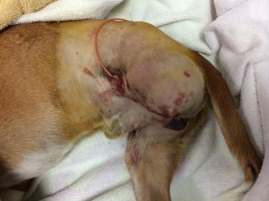 Broozer End of Surgery