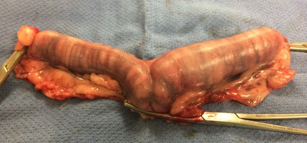 Sandy's large, distended uterus before cutting it open.